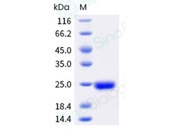 Sino Biological&nbsp;Recombinant cockroaches Bla g 4 Protein