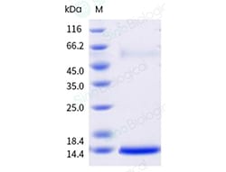 Sino Biological&nbsp;Recombinant Populus nigra Pop n 2 Protein