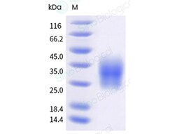 Sino Biological&nbsp;Recombinant Human IL-31 Protein (His & AVI Tag), MALS-verified
