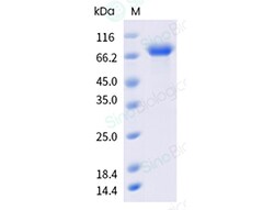 Sino Biological&nbsp;Recombinant Human GAS6 Protein (His Tag), HPLC-verified
