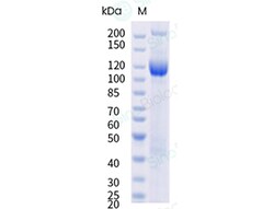 Sino Biological&nbsp;Recombinant Human LRP-6 Protein (hFc Tag)