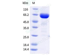 Sino Biological&nbsp;Recombinant Human Alkaline Phosphatase/PLAP/ALPP Protein (His Tag), HPLC-verified
