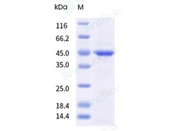 Sino Biological Chlamydia pneumoniae CPBRS034