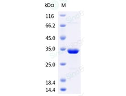Sino Biological&nbsp;Recombinant EBV VCA (P23-P18) protein