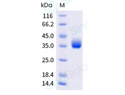 Sino Biological SARSCoV2 Spike 20ug