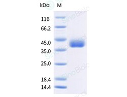 Sino Biological SARSCoV2 Spike 20ug