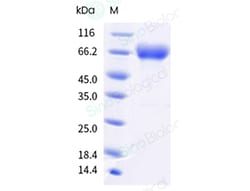 Sino Biological&nbsp;Influenza A H1N1 (strain A/Puerto Rico/8/1934) Hemagglutinin / HA-specific B cell probe Protein (Y108F, AVI & His Tag), Biotinylated