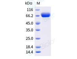 Sino Biological&nbsp;Recombinant Human TL1A/TNFSF15 Protein (MALS-verified, His Tag), MALS-verified