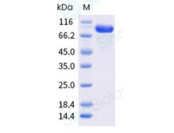 Sino Biological&nbsp;Recombinant Human Desmoglein-2 Protein (His Tag), HPLC-verified