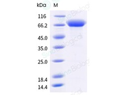 Sino Biological&nbsp;Recombinant Human LRP-6 Protein (His Tag)