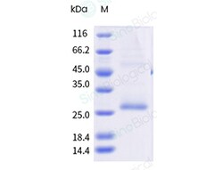 Sino Biological&nbsp;Recombinant Human GPRC5D Protein (Nanodisc, Avi & His Tag), Avi-tag Biotinylated
