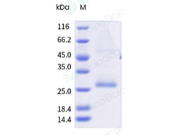 Sino Biological&nbsp;Recombinant Human GPRC5D Protein (Nanodisc, Avi & His Tag), Avi-tag Biotinylated