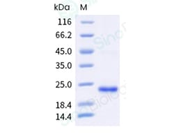 Sino Biological&nbsp;Recombinant Chlamydia pneumoniae OmcB Protein