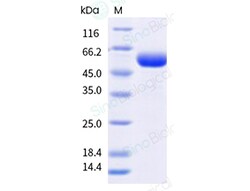Sino Biological&nbsp;Recombinant Human CLEC4C Protein (ECD, hFc Tag)