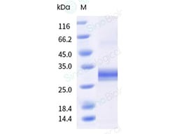 Sino Biological&nbsp;Recombinant Human TL1A/TNFSF15 Protein (His Tag), Trimer, MALS-verified