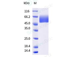 Sino Biological&nbsp;Recombinant Mouse CD98 Protein (His & AVI Tag), Avi-tag Biotinylated, HPLC-verified
