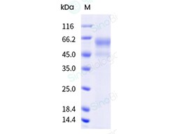 Sino Biological&nbsp;Nipah virus Fusion glycoprotein (His Tag)