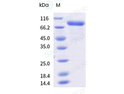 Sino Biological&nbsp;Recombinant Human KIR3DL1 Protein (ECD, hFc Tag), HPLC-verified