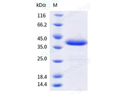 Sino Biological&nbsp;Monkeypox Virus (MPXV) (Clade Ib) A5L Protein (His Tag)