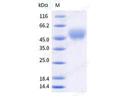 Sino Biological&nbsp;Recombinant Mouse B7-H4 Protein (His Tag), Amine-Labeled Biotinylated, HPLC-verified
