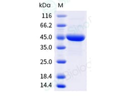 Sino Biological&nbsp;Recombinant Blattella germanica Bla g 2 Protein