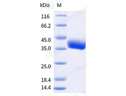 Sino Biological SARSCoV2 Spike 20ug