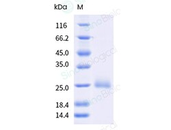 Sino Biological&nbsp;Recombinant Human PGRP-S/PGLYRP1 Protein (His Tag), HPLC-verified