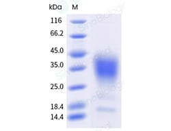Sino Biological&nbsp;Recombinant Human IL-13 Protein (His Tag), HPLC-verified