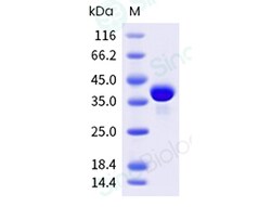 Sino Biological&nbsp;Recombinant Human PTP1B Protein (His & AVI Tag), Biotinylated, HPLC-verified