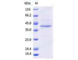 Sino Biological&nbsp;Recombinant Human CD20 Protein (Nanodisc, Full-length, Strep & His)