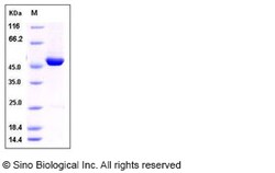 Sino Biological Recombinant Mouse kynureninase/KYNU Protein (His Tag),