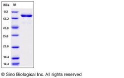 Sino Biological Recombinant Mouse Src Protein (His & GST Tag), Quantity: