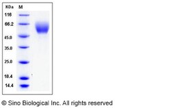 Sino Biological Mouse SerpinA6 / CBG Protein (His Tag) 100ug, Quantity: