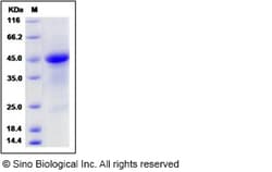 Sino Biological Mouse R-Spondin 1 / RSPO1 Protein (His Tag) 100ug, Quantity: