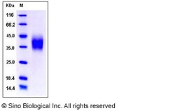 Sino Biological Recombinant Mouse CD16/FCGR3/Fc gamma RIII Protein (ECD,