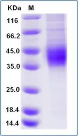 Sino Biological Mouse CD16 / FCGR3 Protein (His & AVI Tag), Biotinylated