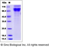 Sino Biological Mouse IL17RA / IL17R / CD217 Protein (Fc Tag) 100ug, Quantity: