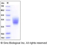 Sino Biological Recombinant Mouse CD147/Basigin/EMMPRIN Protein (His Tag),