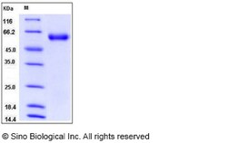 Sino Biological Mouse Angiotensinogen / SerpinA8 / AGT Protein (His Tag)