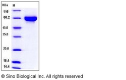 Sino Biological Mouse KIRREL3 / NEPH2 Protein (His Tag) 100ug, Quantity: