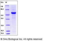 Sino Biological SARS-CoV-2 (2019-nCoV) 3CLpro / 3C-like protease-His &