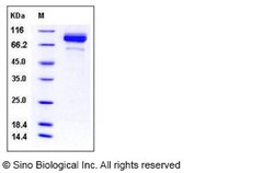 Sino Biological Recombinant Mouse Coagulation Factor II Protein (His Tag),