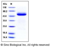 Sino Biological Mouse Cathepsin A / CTSA Protein (His Tag) 50ug, Quantity: