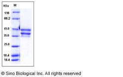 Sino Biological Mouse BAFFR / TNFRSF13C / CD268 Protein (Fc Tag) 100ug,