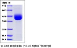 Sino Biological Mouse ANGPTL4 Protein (His Tag) 100ug, Quantity: Each of