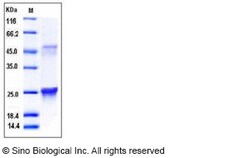Sino Biological Recombinant Mouse GLO1 Protein (His Tag), Quantity: Each