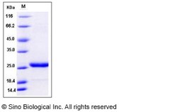 Sino Biological Recombinant Mouse Prolactin Protein (His Tag), HPLC-verified,