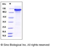 Sino Biological Recombinant Mouse alanyl-tRNA synthetase Protein (His Tag),