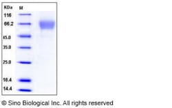Sino Biological Recombinant Mouse Tim4/TIMD4 Protein (His Tag) 1, Quantity: