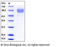 Sino Biological Recombinant Mouse Tim4/TIMD4 Protein (His Tag), Quantity: